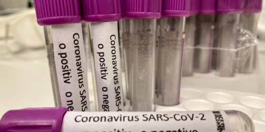 Test tubes labeled with "coronavirus"